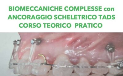 Biomeccaniche complesse con ancoraggio scheletrico tads